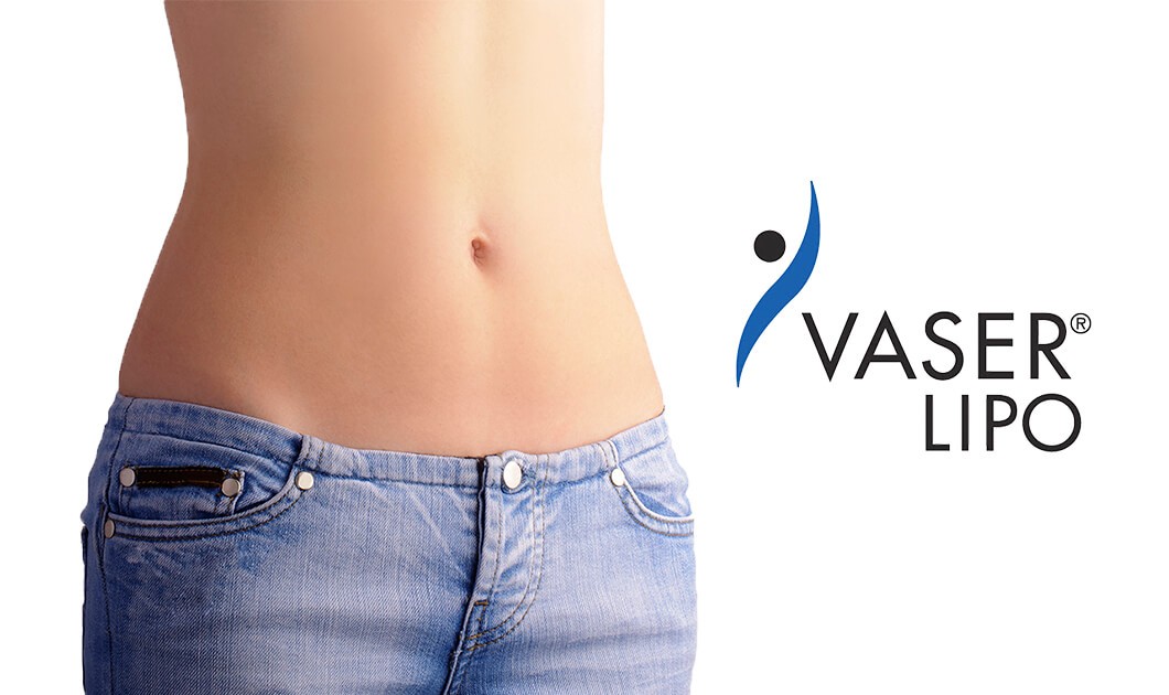 hizmet Vaser Liposuction Nedir?