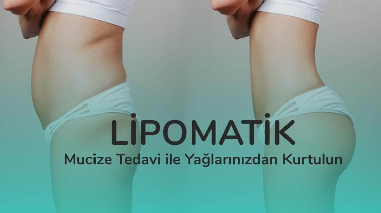 Lipomatik Nedir?