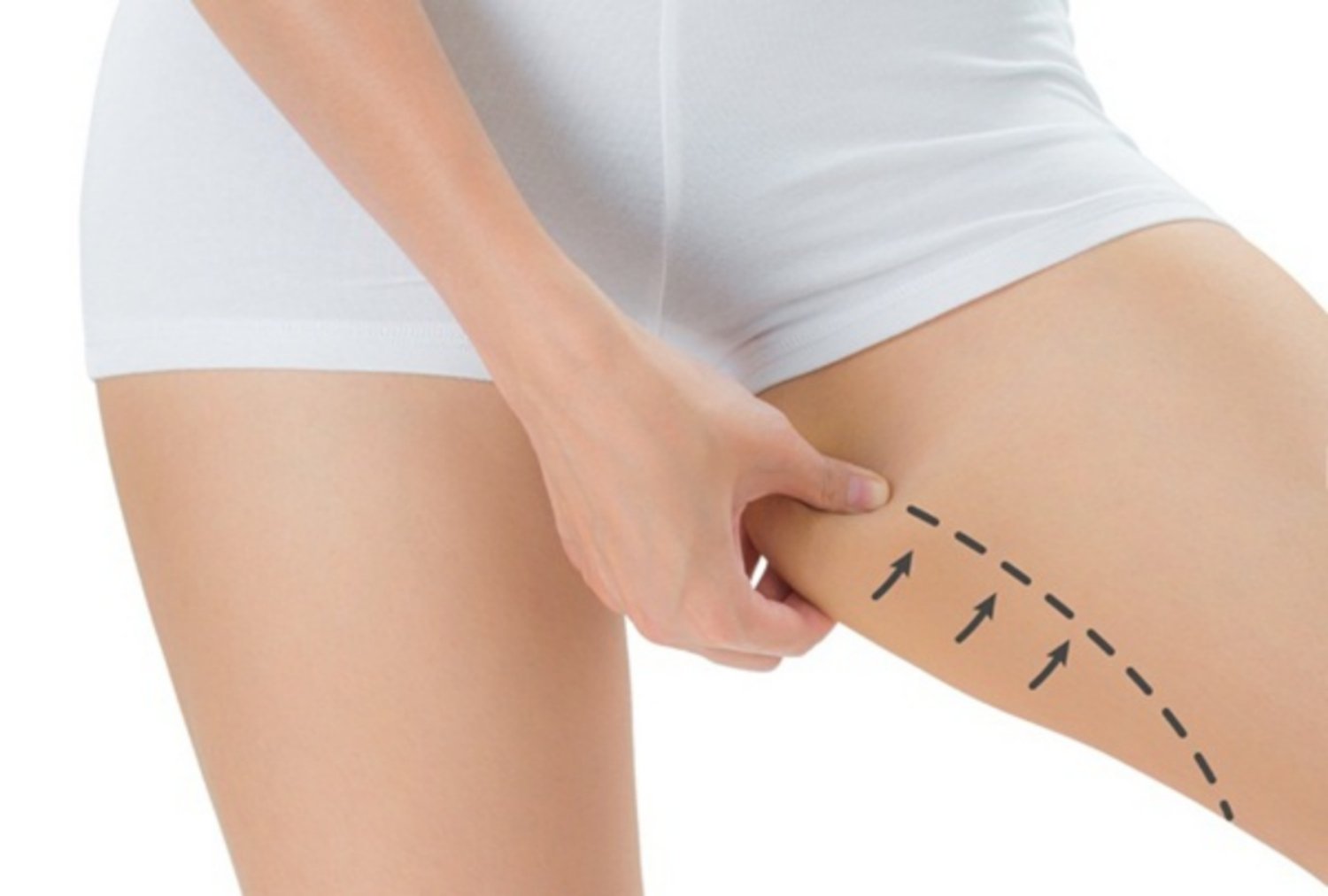 hizmet Bacak Liposuction İstanbul