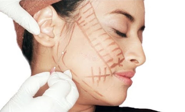 Reflect Your Joy On Your Face With Face Lift Surgery Turkey