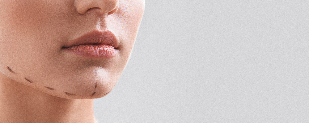 What Is Chin Aesthetics? Who Is It For?