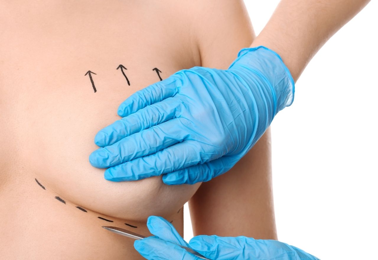 Things to Consider After Breast Aesthetic Surgery