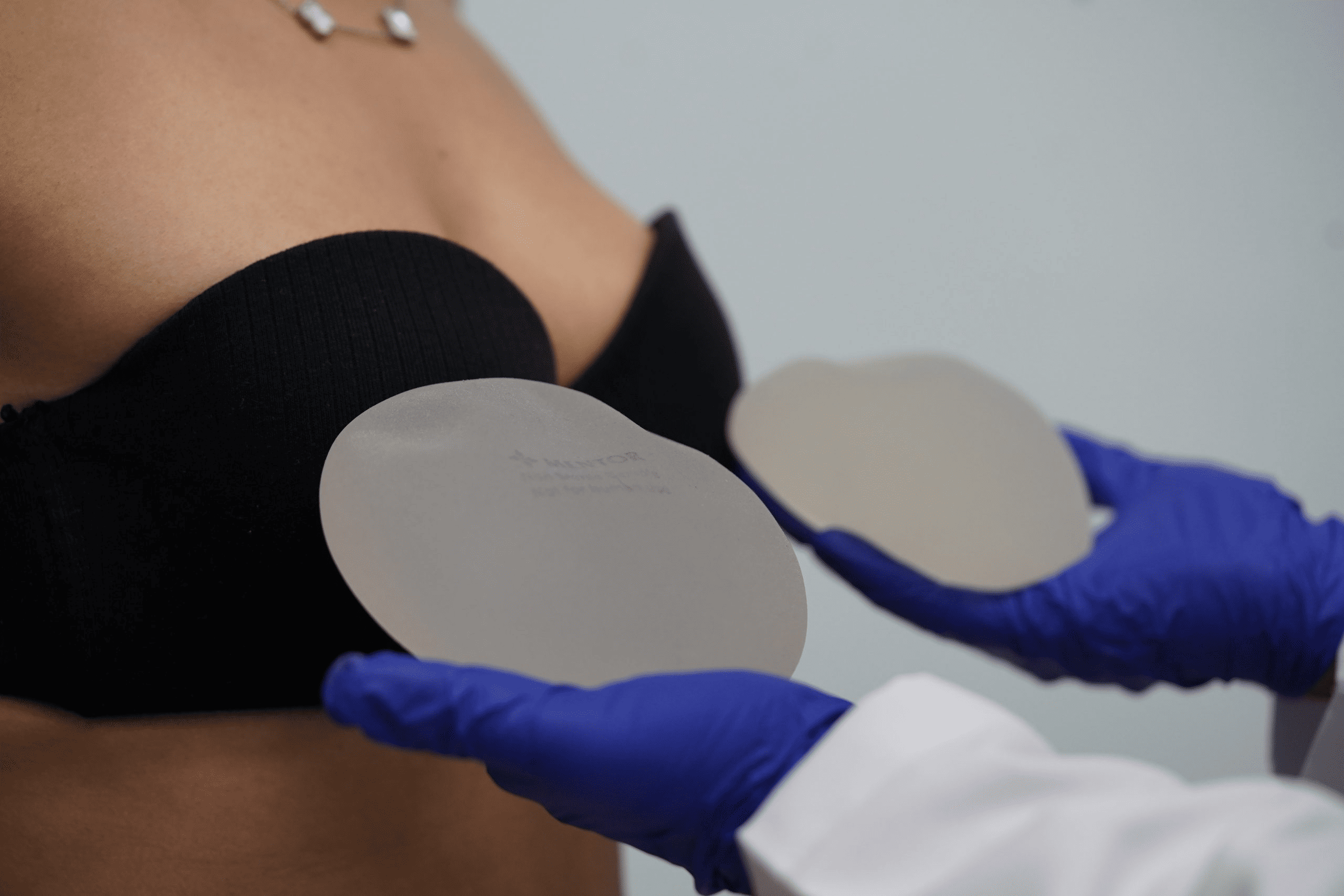 Silicone or Fat Injection? A Guide to Choosing the Right Breast Augmentation Method