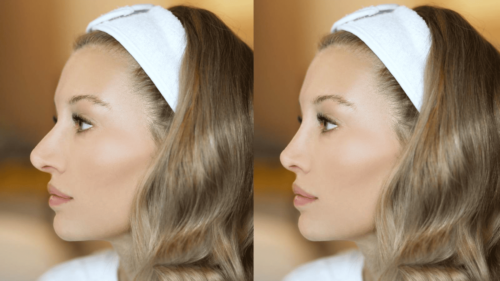 Natural Appearance Aesthetics: Understated but Effective Results